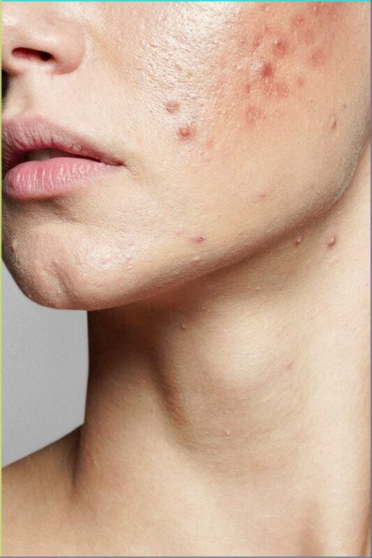 Oily Skin Routine
