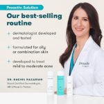 skincare routine acne