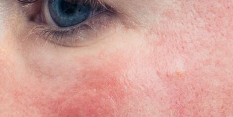 sensitive-skin-care-routine