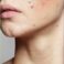 face lotion for sensitive skin