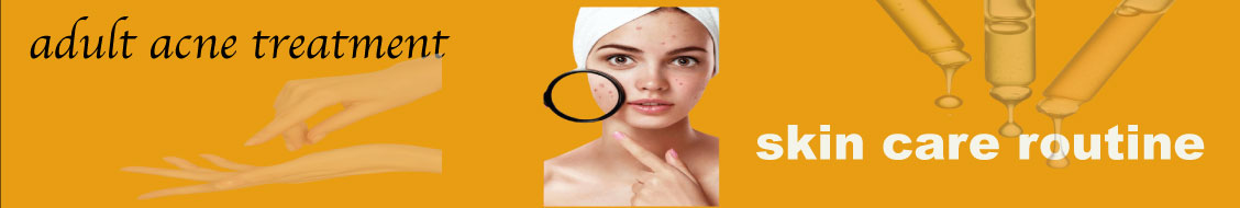 adult acne treatment
